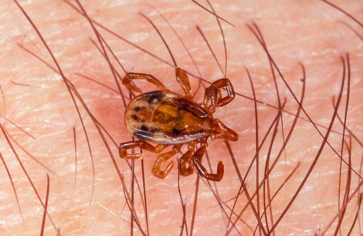 How To Remove Ticks and Prevent Tick Bites We Are Explorers